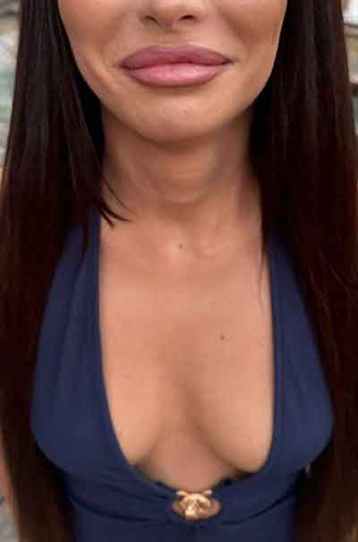 Rakel, 43 år
